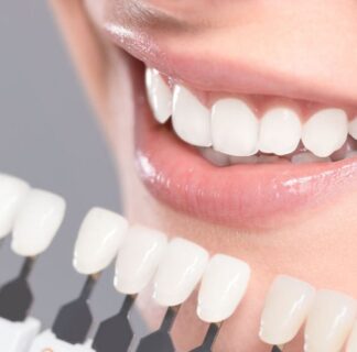 Nano Teeth Whitening