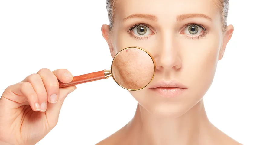 Pigmentation Treatment